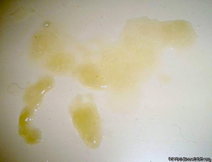 Semen