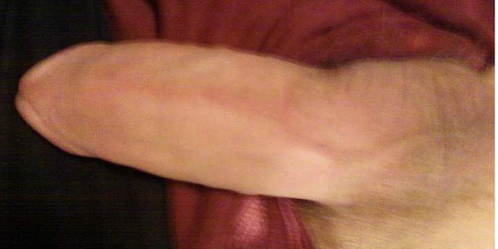 Photo of a third leg from CLinz49