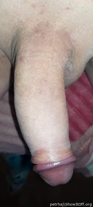 my dick normal