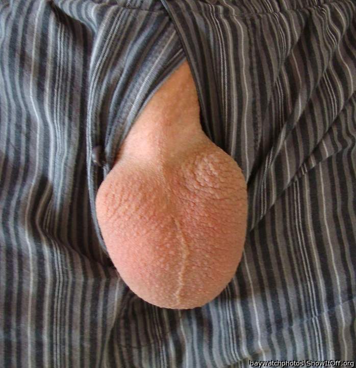 Testicles Photo from baywatchphotos