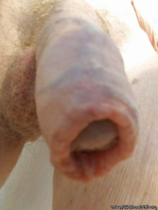 Foreskin