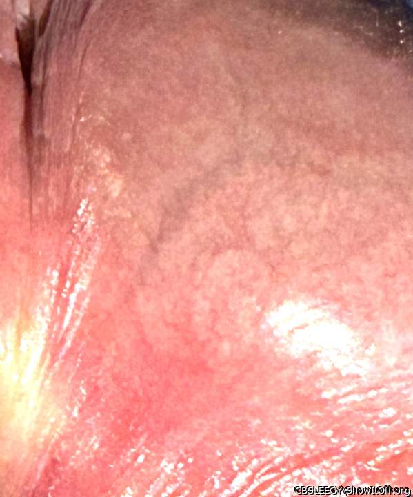 Main vein going into Peehole with a Celtic Knot vein structure!