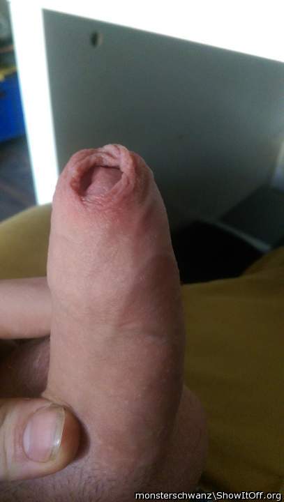 foreskin