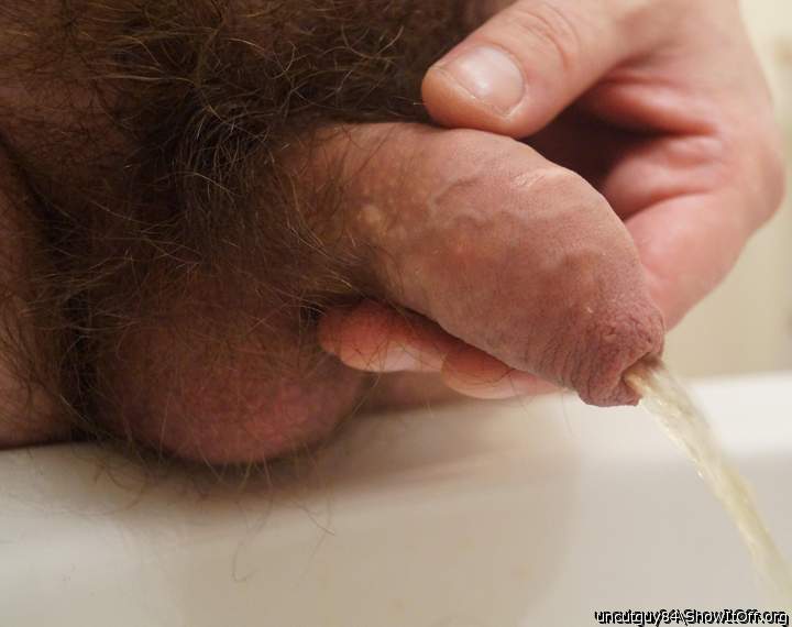 Photo of a private part from uncutguy84