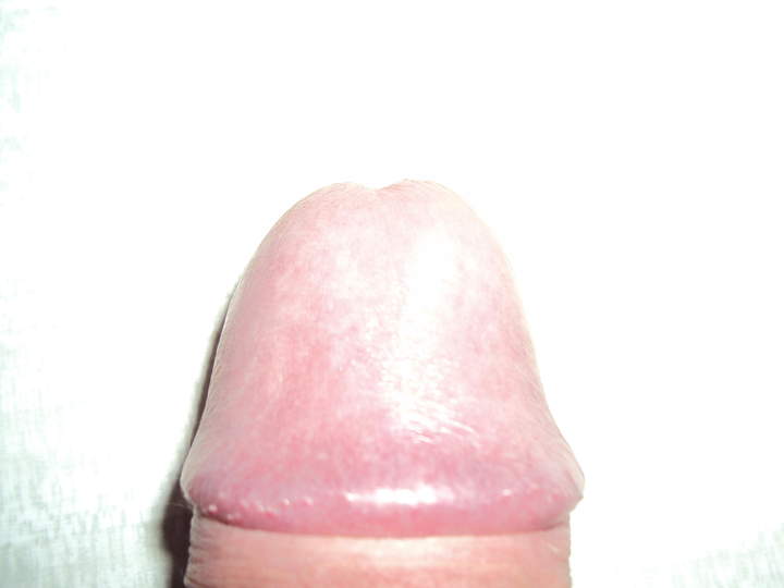 Glans