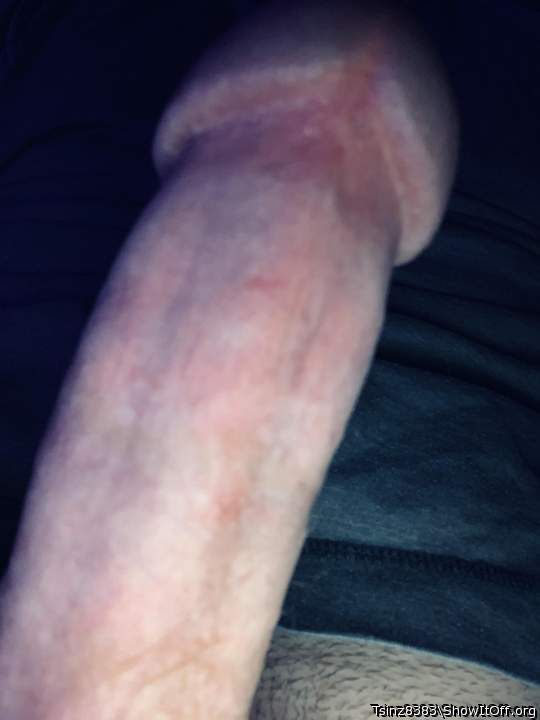 Photo of a short leg from Tsinz8383