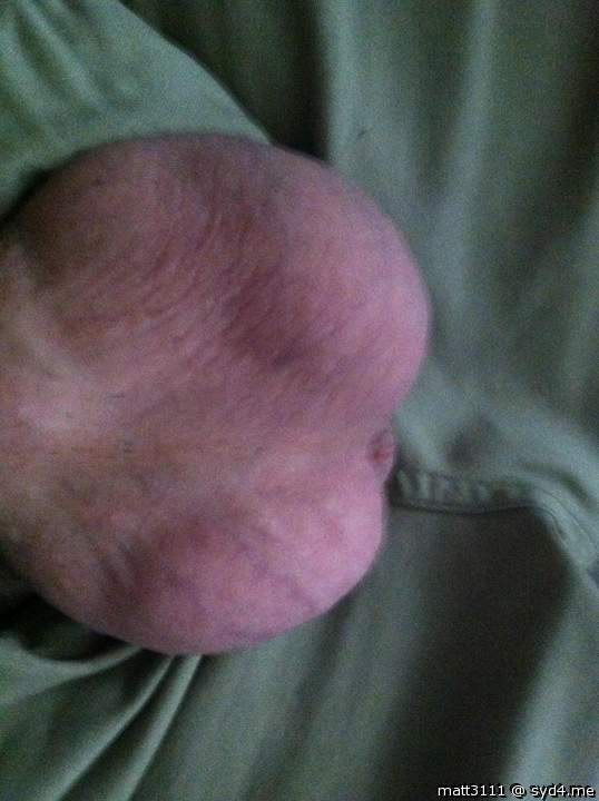 Testicles Photo from Matt3111