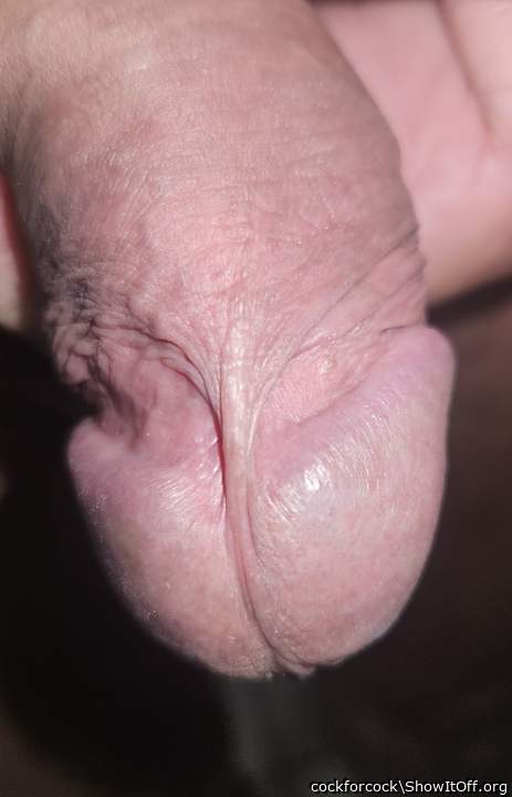 Tight frenulum