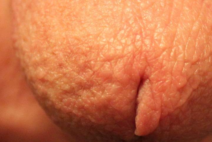 My pee slit up close