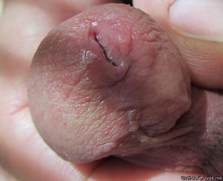 Photo of a prick from lilsoftee