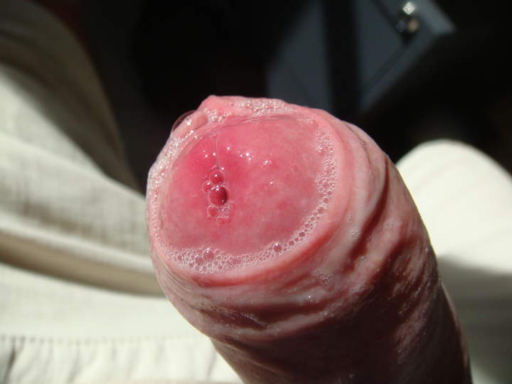 Photo of a bald-headed mouse from sivad666