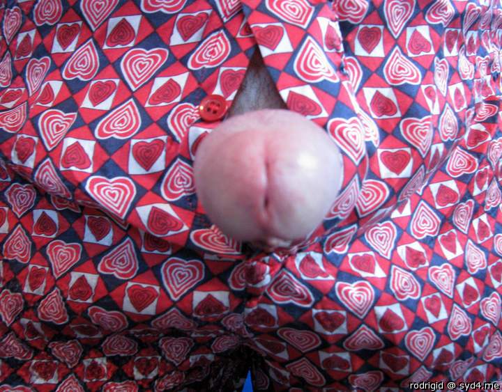 Photo of a short leg from rodrigid