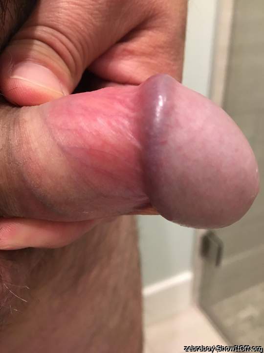 Beautiful exposed glans