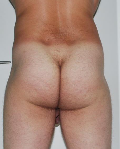 My ass