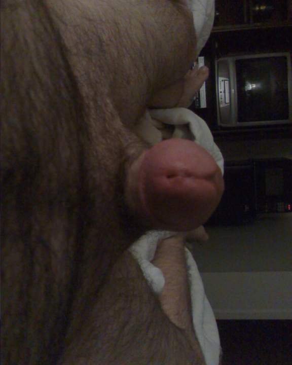Photo of a short leg from sethvir18