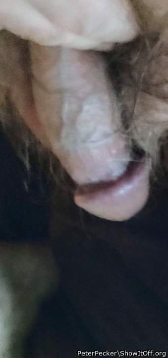 Photo of a penis from PeterPecker