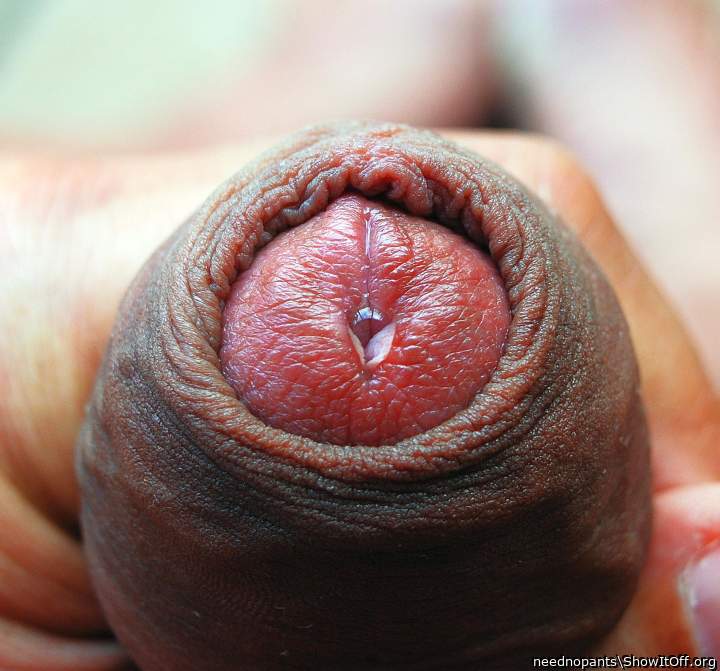 Photo of a prick from neednopants