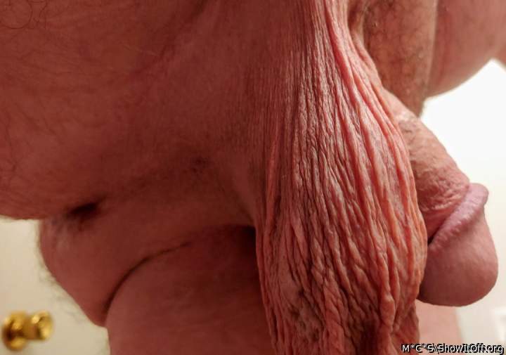 Photo of a penile from M*C*S