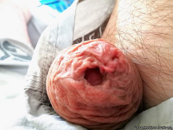beautiful foreskin!