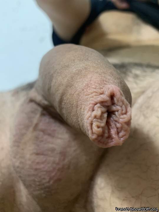 Photo of a short leg from Franc0