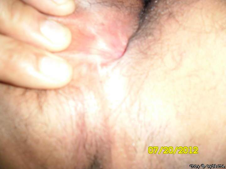 Photo of a penis from choy