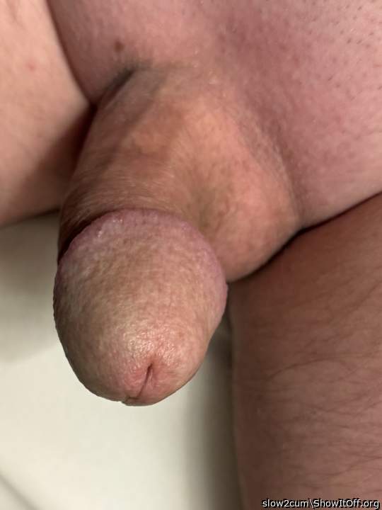 Photo of a penile from slow2cum