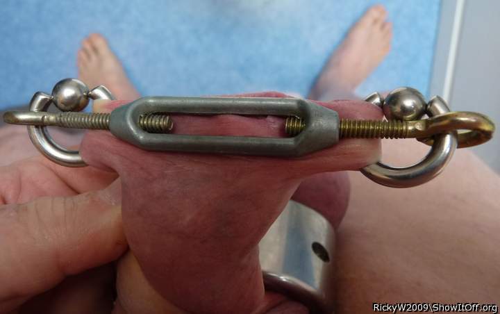 How the stretcher works