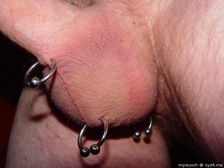Testicles Photo from mywusch