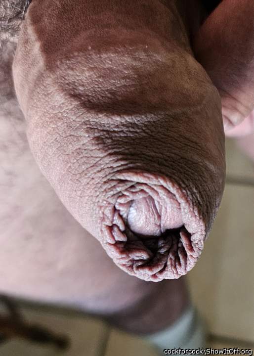 Foreskin galore
