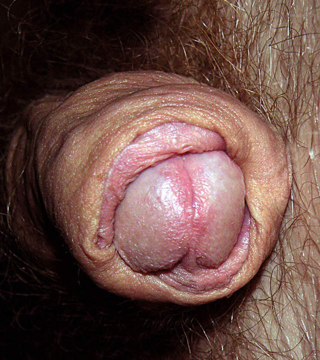 mmm----hot foreskin view !!!