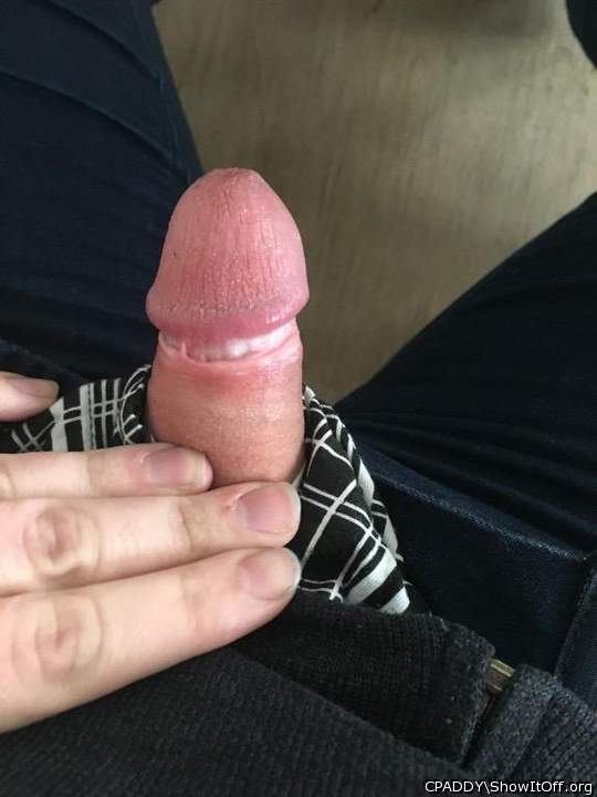 My Circumcised Dick-Do you like it?