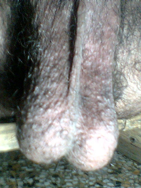 Testicles Photo from luvmycock