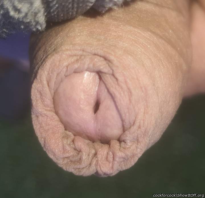 His super foreskin
