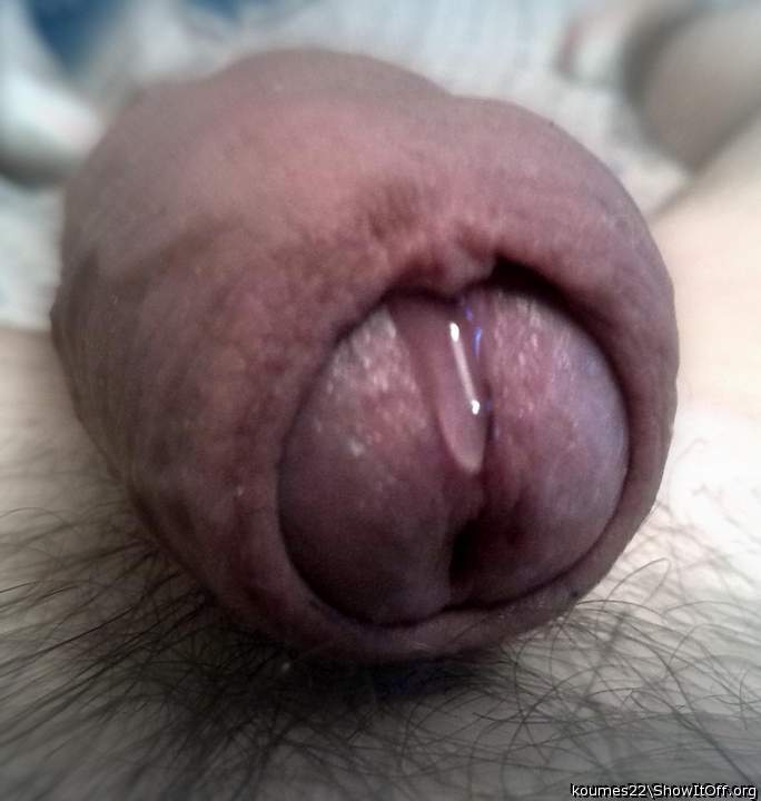 Great pic of your weeping willy. Definately needs some atten