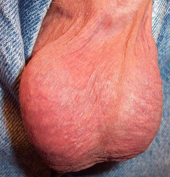 Testicles Photo from lilsoftee