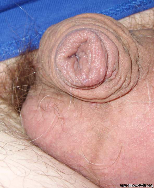 Bold foreskin close up