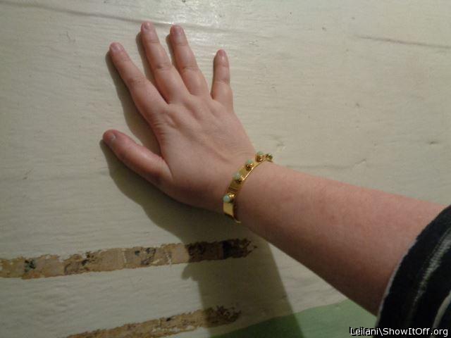 My arm and hand. Markings on arm are insect bites. I was touching Alcatraz.