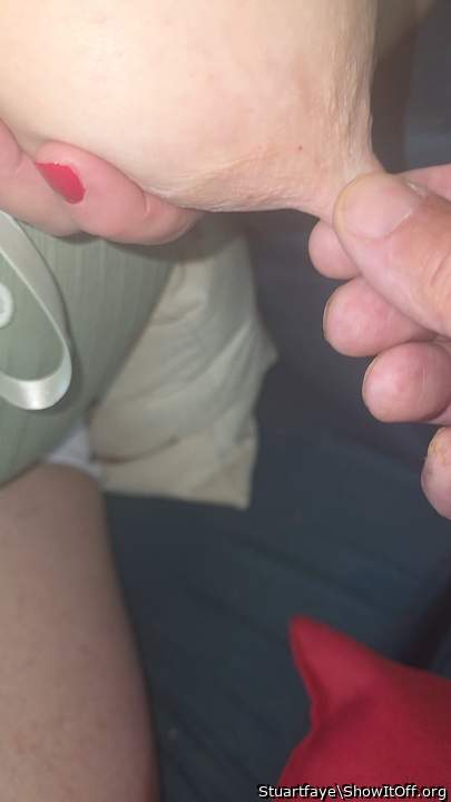 Photo of a short leg from Stuartfaye