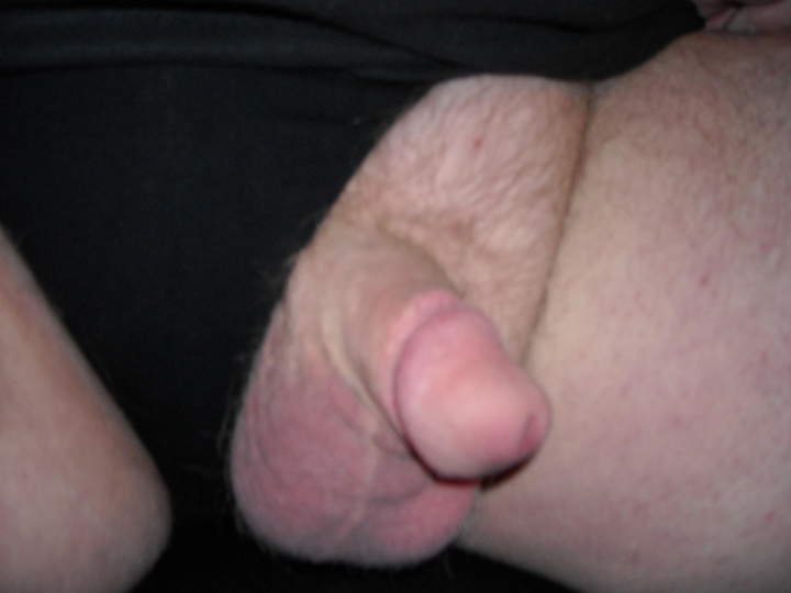 Photo of a bald-headed mouse from fronve