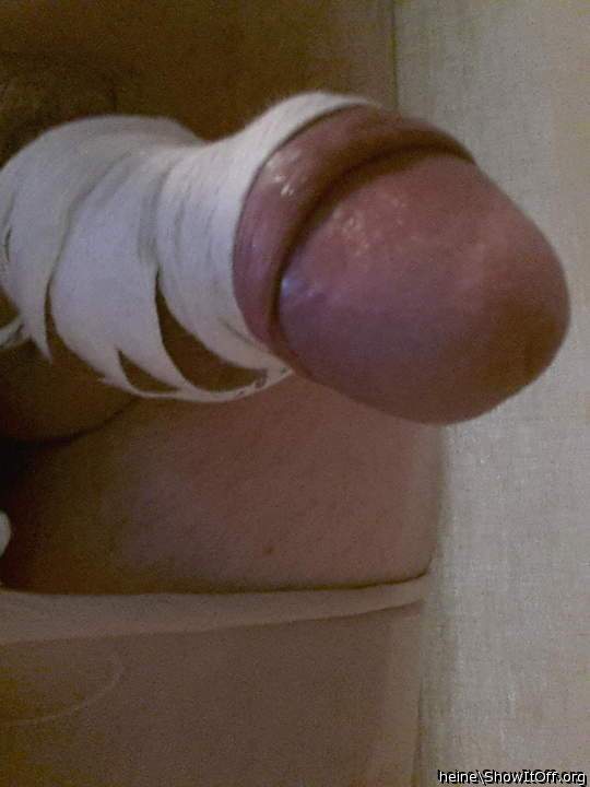Photo of a prick from heine