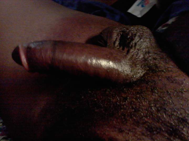 Photo of a penile from Assman80