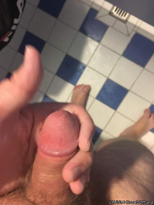 My Circumcised Dick-Do you like it?