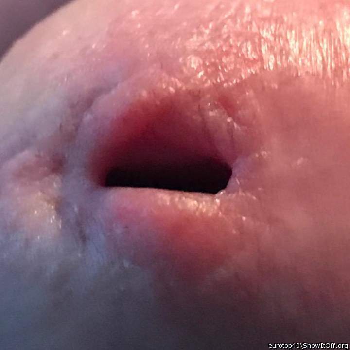 Photo of a short leg from eurotop40