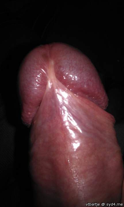 Photo of a wiener from vtbartje