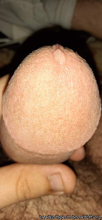 Testicles Photo from DeadEndSperm