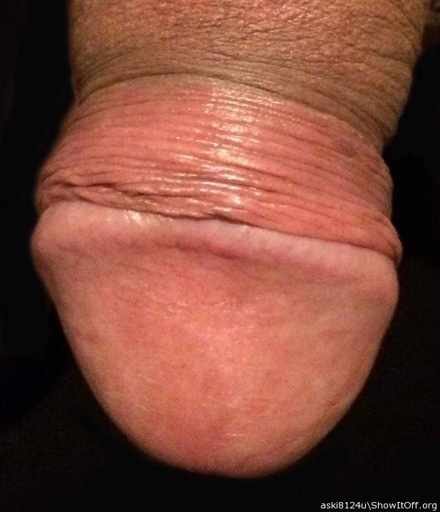 my head