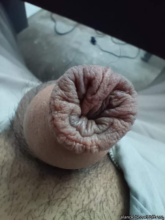 Photo of a middle leg from alanck