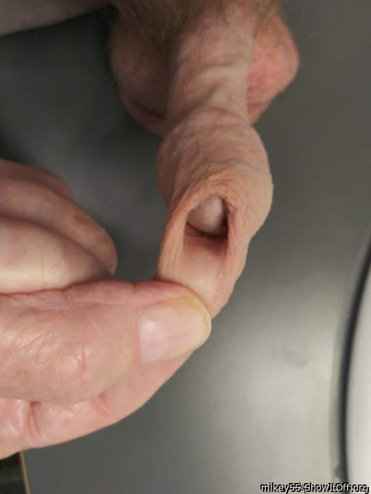 Foreskin