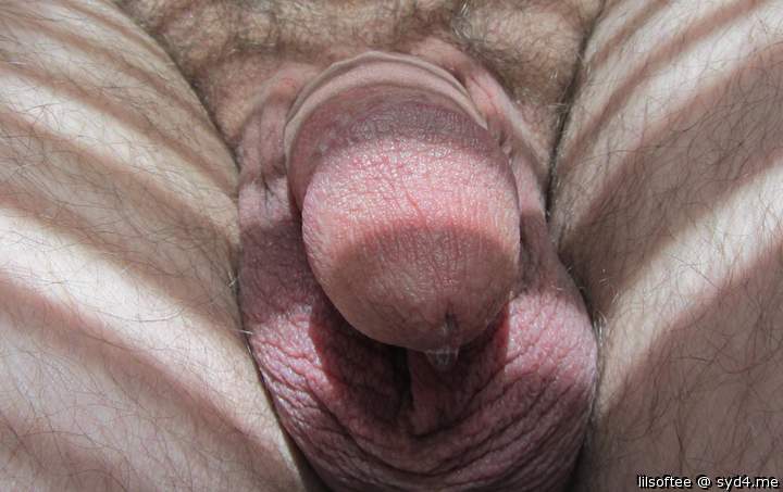 Photo of a short leg from lilsoftee