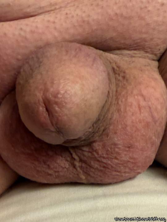 Photo of a middle leg from slow2cum